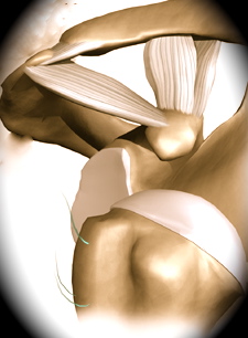 shoulder_instability_intro01